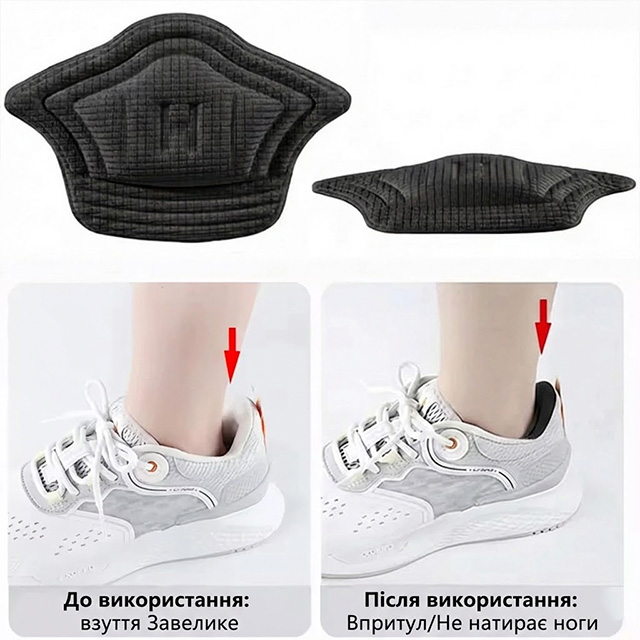 Фіксація п'яти